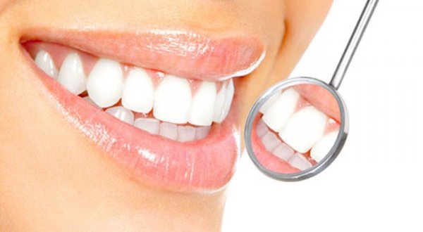 Реставрации зубов